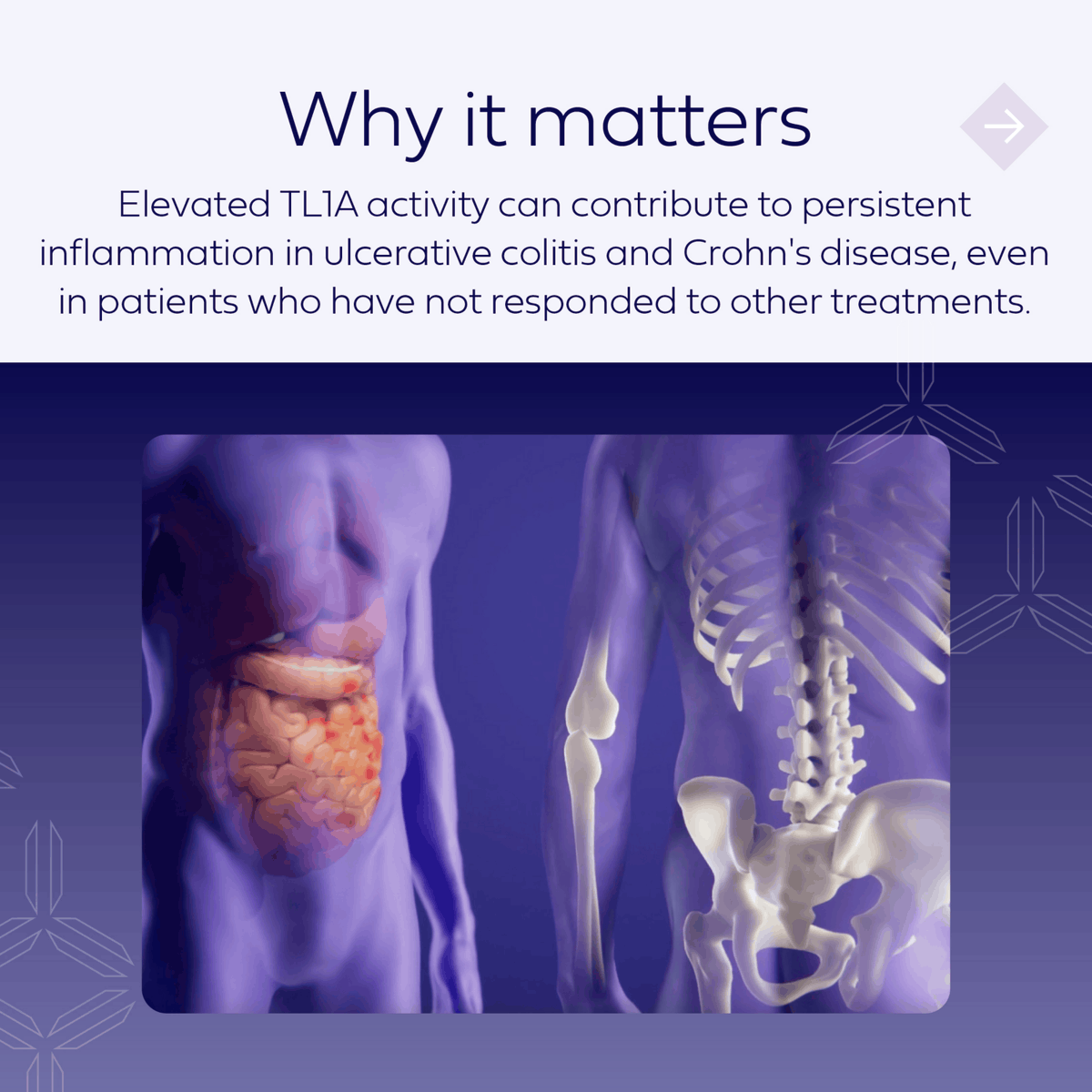 spyretx's tweet photo. TL1A plays a key role in activating immune cells &amp; driving persistent inflammation in #IBD. We are investigating SPY002, a novel, half-life extended investigational monoclonal antibody targeting TL1A for potential treatment of IBD. FLS: https://t.co/iGjmIeWQpd MoA: @visualscience https://t.co/M2o9Y8vzEU