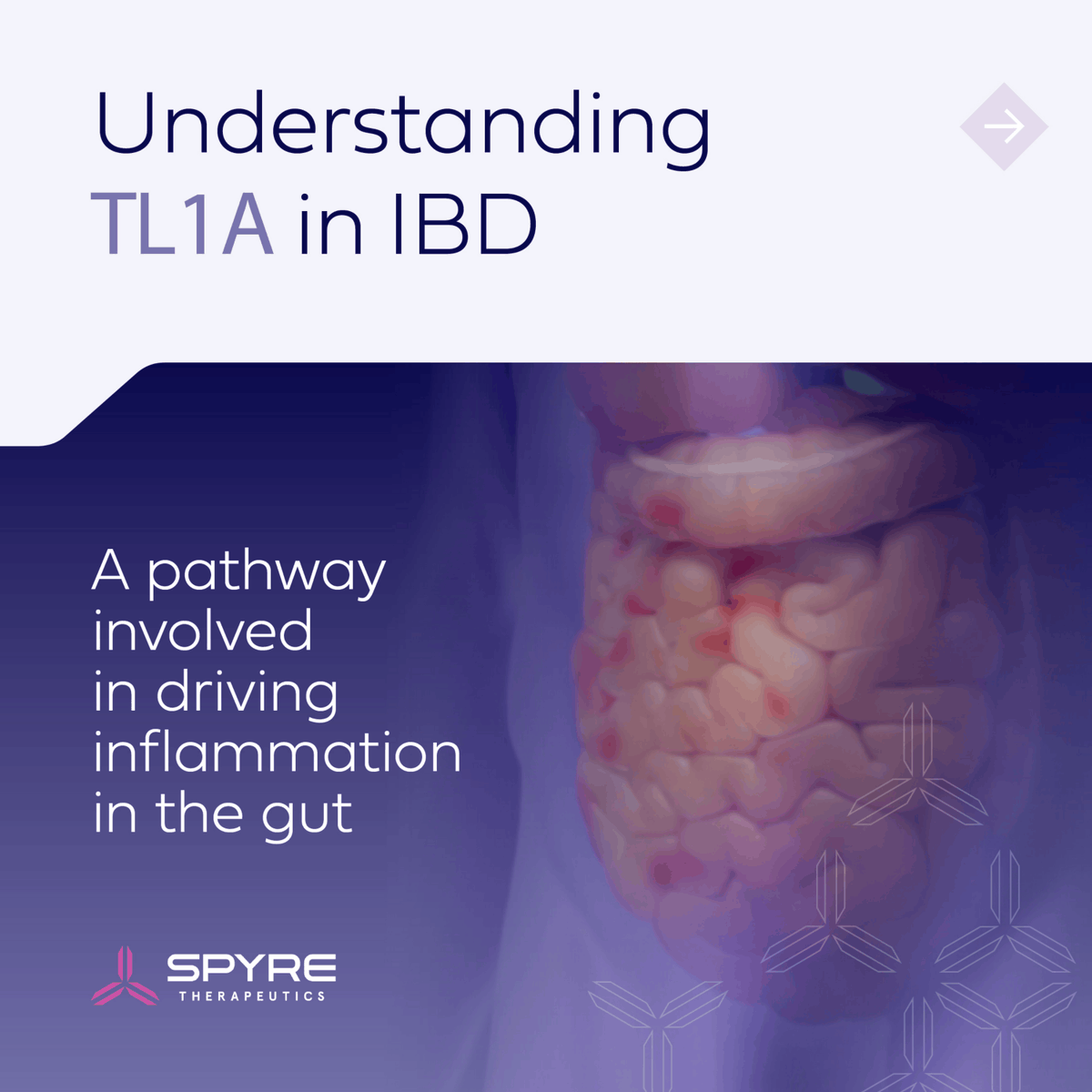 spyretx's tweet photo. TL1A plays a key role in activating immune cells &amp; driving persistent inflammation in #IBD. We are investigating SPY002, a novel, half-life extended investigational monoclonal antibody targeting TL1A for potential treatment of IBD. FLS: https://t.co/iGjmIeWQpd MoA: @visualscience https://t.co/M2o9Y8vzEU