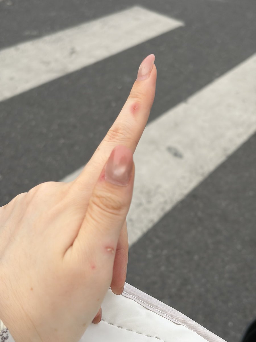 linn_ooin's tweet photo. 求自己不要再不误伤自己了。 https://t.co/CMhJiq3dDV