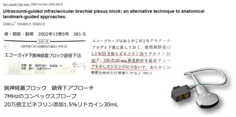 世界で初めて、超音波ガイド下末梢神経ブロック実施の報告をしたのは