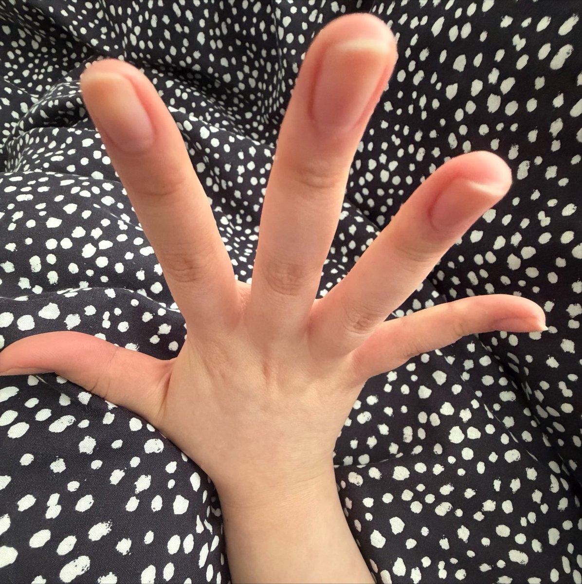 deyluvaro's tweet photo. i cut my nails https://t.co/F8k0UnQ4wQ