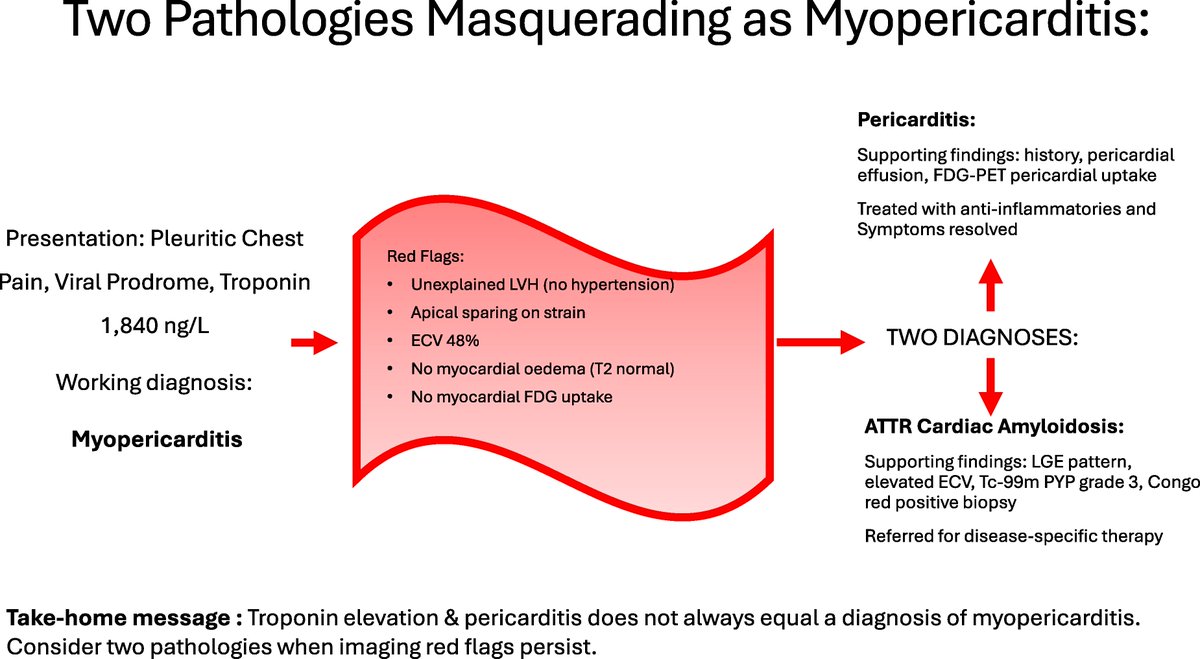 ESC_Journals's tweet photo. Pericarditis can distract from the bigger diagnosis. This case shows how troponin-positive chest pain with normal coronaries, apical sparing, diffuse subendocardial LGE and high ECV should prompt definitive testing for ATTR-CM. https://t.co/uhlFGCcM2T 

#EHJCaseReports @Phiso_de @TJ_Yeo @girishviswa @sukritibanthiya  @O_Azizy_MD @saramoscatelli7 @EHJCREiC #CardioX