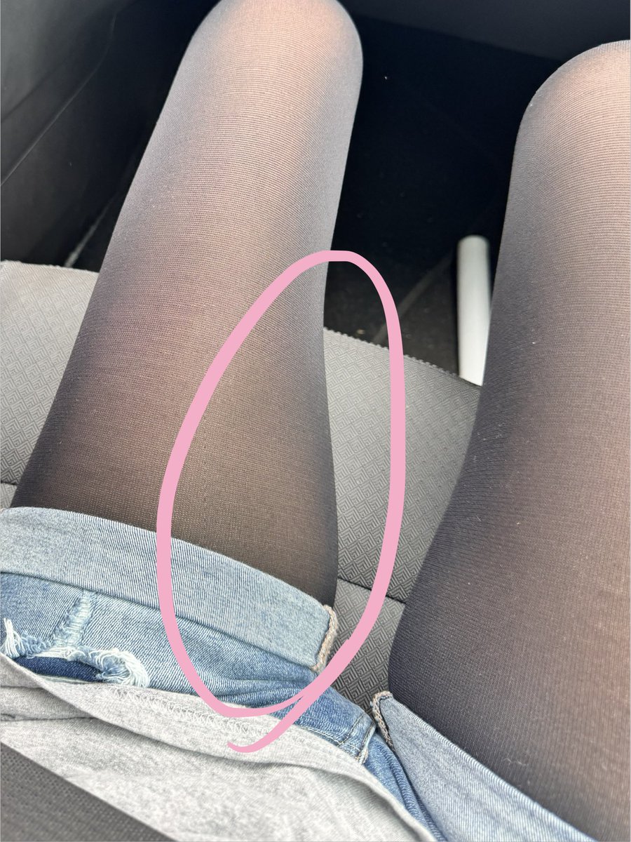 pink_is_stupid's tweet photo. someone cut that shit off my leg i beg you oh my god get the scissors https://t.co/0ZSQiO0Dkq