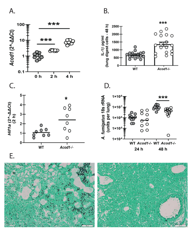 ASMicrobiology's tweet photo. The TCA cycle intermediate itaconate hinders lung clearance of the fungus Aspergillus fumigatus via regulating multiple immune mechanisms. This study in #mBio uncovers a new mechanism of immune regulation during fungal pneumonia. Read the article: https://t.co/IpIFjRMrWG https://t.co/442xDy1are