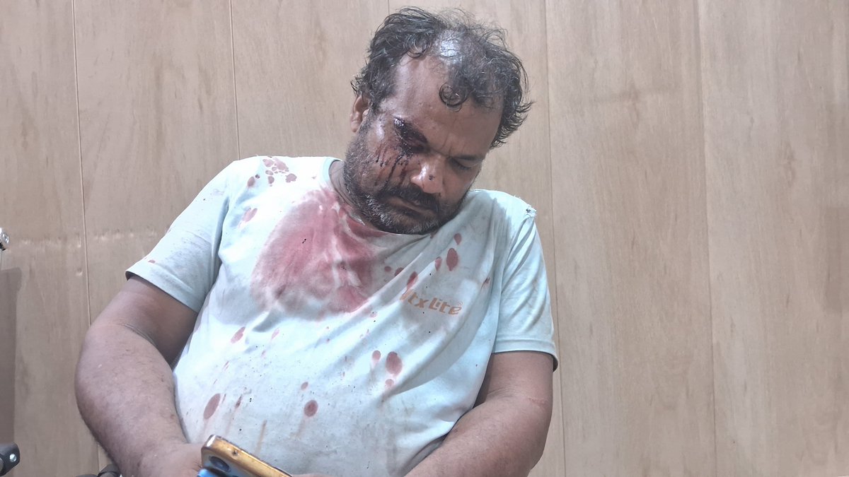 abdul3575's tweet photo. कुछ देर पहले शानू सैफी पर चाकू से हमला कर दिया गया है मामला लखनऊ के मदेयगंज थाना क्षेत्र के खदरा बड़ी पकरिया का है जहाॅ पर पानी मांगने को लेकर हमलावर शाहरुख, शकील गाज़ी सहित 5-6 दोस्तो ने मिल कर घेरा और हमला कर दिया फिलहाल शाहरुख हिरासत मे है आगे की कार्रवाई जारी है @lkopolice https://t.co/Lgab9kw2F7