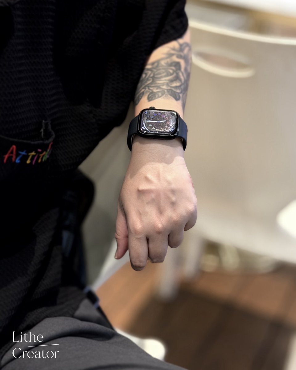 LitheCreator2's tweet photo. 恢复2个月的星星✨

#bodymodifications 
#bodymodification 
#subdermalimplant 
#siliconeimplant 
#bodymods 
#bodymod 
#人体改造 
#硅胶植入 https://t.co/1VPiokHNHX
