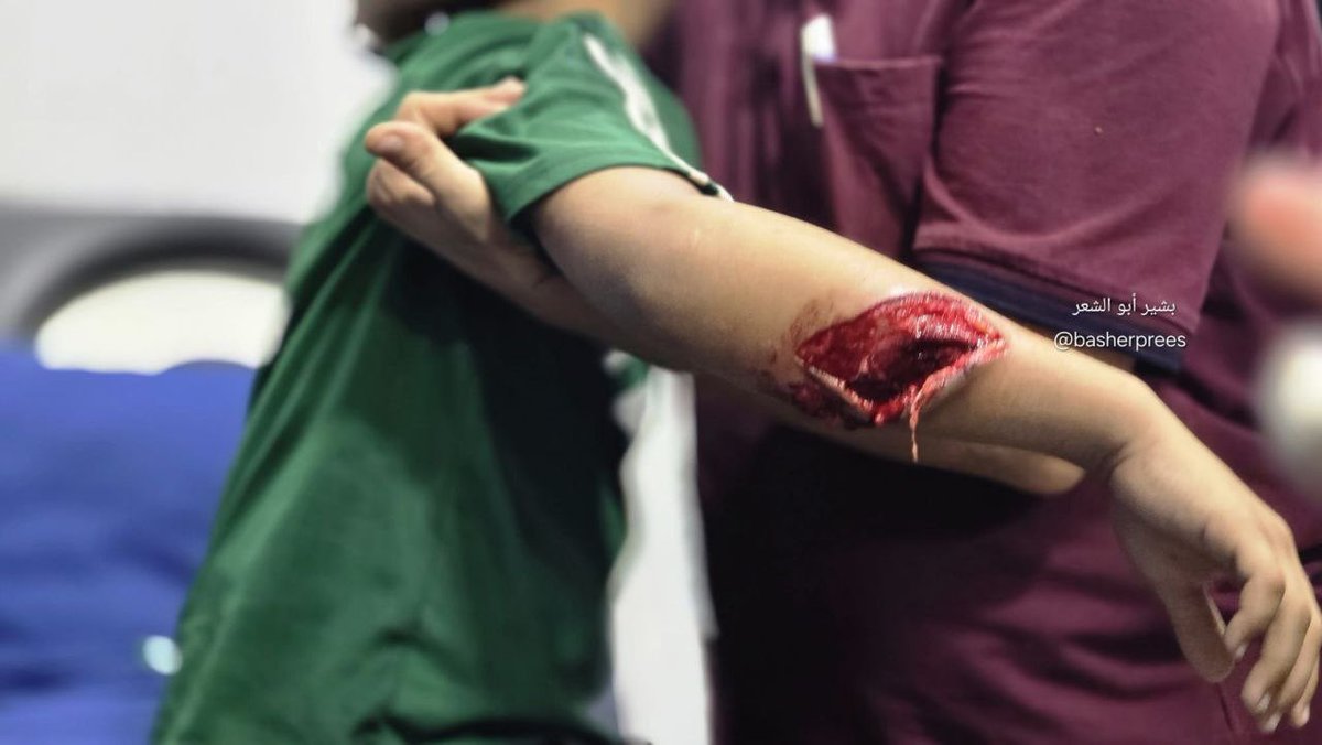 MosabAbuToha's tweet photo. An Israeli quadcopter drone opened fire on 12-year-old Baraa Abdullah Ghazal in the Al-Tuffah neighborhood, east of Gaza City, wounding him. He was taken to Al-Ahli Arab (Baptist) Hospital for treatment. https://t.co/Madh1qZ51e