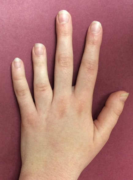 IhabFathiSulima's tweet photo. What is te metabolic diagnosis ? https://t.co/ZIxeLARxc8