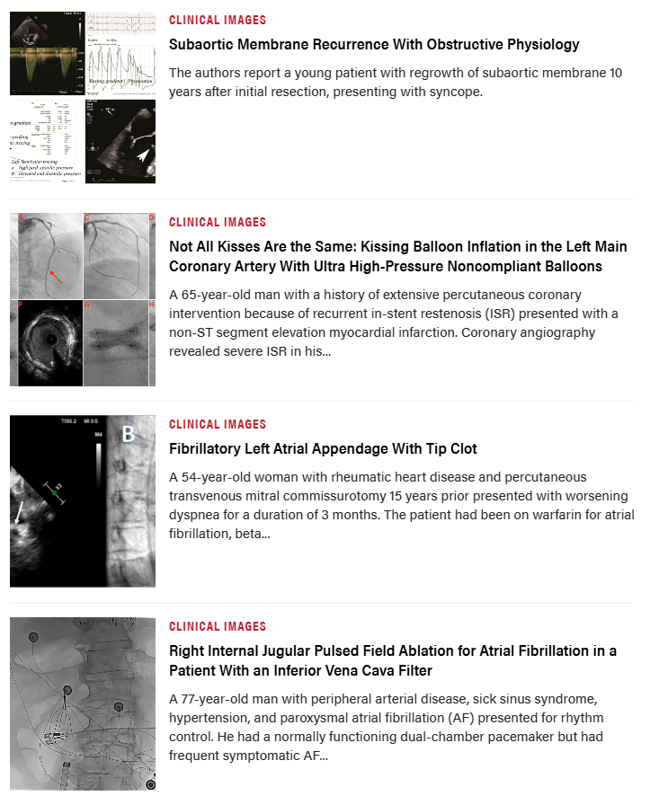InvasiveCardiol's tweet photo. 📚 The August issue is out now!

Read here ➡️https://t.co/MI29UqI57m

@CCAD_MHIF @RafiqueSoomal @gregoffiah @NoReflow
@DLBHATTMD #cardioTwitter #cardioX #cardiology #interventionalcardiology https://t.co/eCDIlyxy99