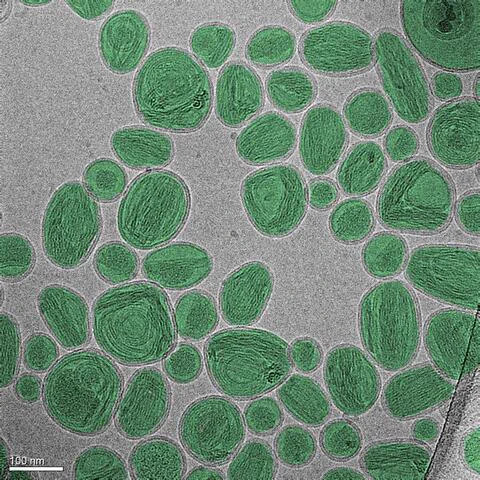 A colorized electron microscope image shows lipid nanoparticles containing a cancer drug. The green cells float on a gray background/ 