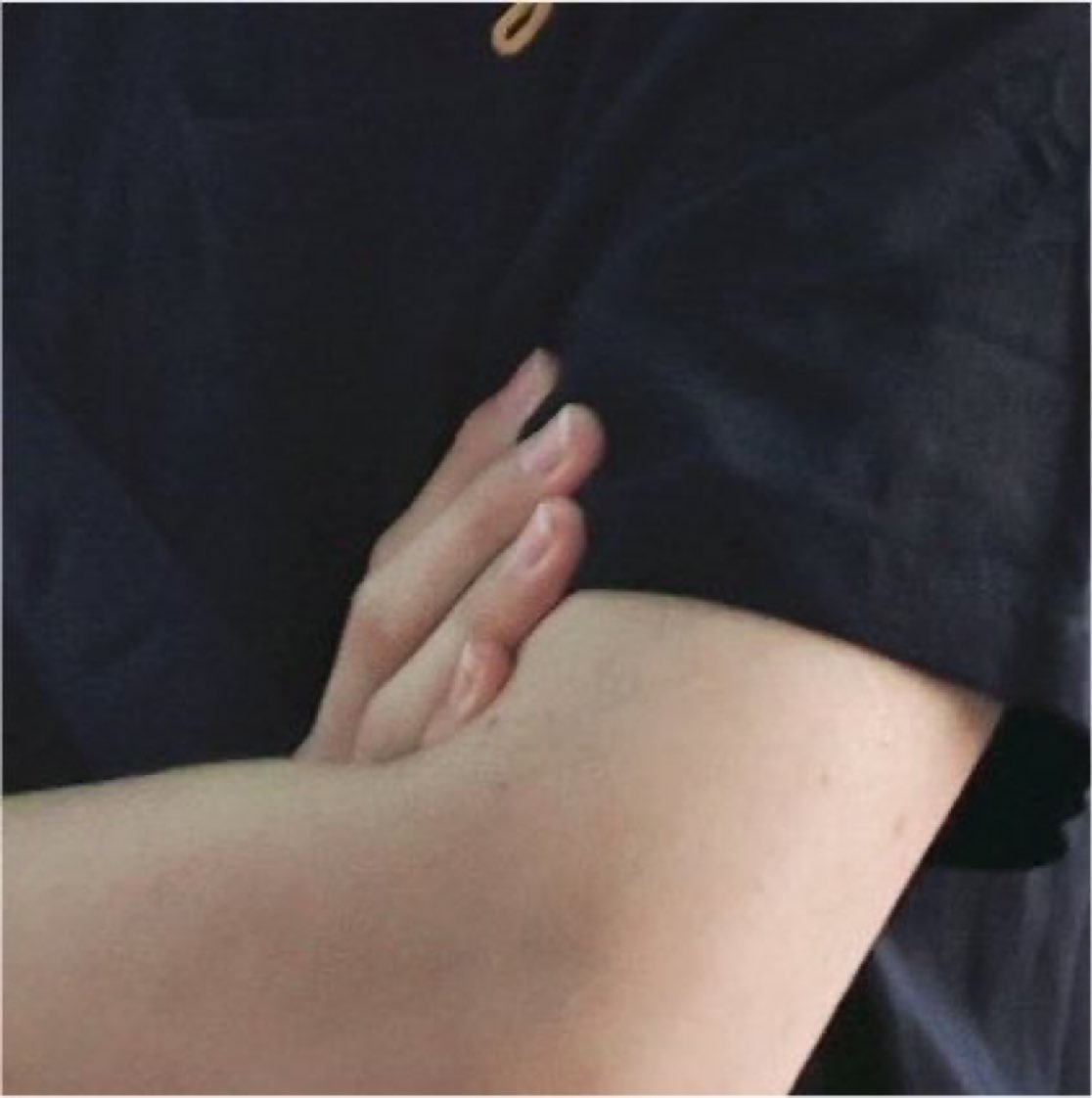 pictoru_'s tweet photo. DM จองอู🥹

🐺: ใครที่เคยเห็นเล็บของผม
🐺: ตอนนี้ผมมีเรื่องจะอวดแล้ว
🐺: ช่วยดูหน่อยได้ไหม? สำหรับคนที่ยังไม่เคยเห็น
🐺: ผมไว้เล็บยาวได้แล้ว
🐺: ผมเลิกกัดเล็บได้แล้ว
🐺: ก่อนจะย้ายมาโซล ผมทั้งกัด ทั้งแคะ ทั้งลอกเล็บแบบนี้มาตลอด
🐺: รู้สึกภูมิใจในตัวเองนิดหน่อย
🐺: ถ้าถามว่าผมเลิกได้ยังไง
🐺: ก็ไม่มีวิธีพิเศษอะไรหรอก
🐺: ตั้งแต่วันที่ผมคิดว่า "จะไม่แคะเล็บอีกแล้ว"
🐺: ผมก็ไม่แคะมันอีกเลย
🐺: ด้วยความตั้งใจอย่างแรงกล้า
🐺: และด้วยหัวใจที่มุ่งมั่นสุดๆ 

//ชั้นมีน้ำตากับเรื่องนี้อ่ะ น้องไม่กัดเล็บตัวเองแล้ว แล้วน้องก็ภูมิใจที่น้องทำได้ ชั้นก็ภูมิใจในตัวน้องเหมือนกัน🥺😭