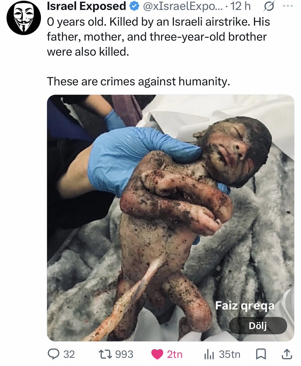 VexLara's tweet photo. @NoaMagid This baby didn’t even have the chance to be born https://t.co/gOL31vq0Wg