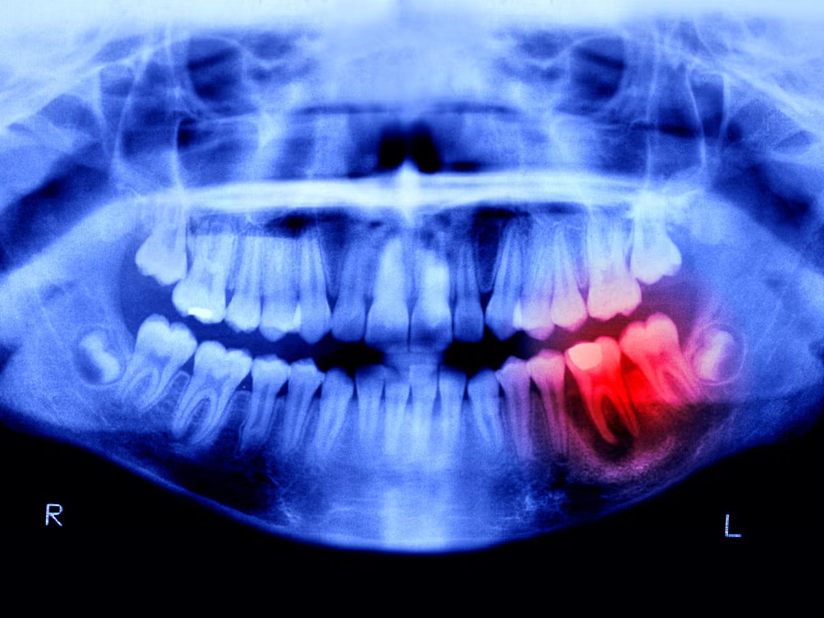 NightSkyToday's tweet photo. 🚨: Humans May Be Able to Grow New Teeth Within Just 4 Years.

Scientists are on the verge of a dental miracle. https://t.co/oYM6Ze1gYH