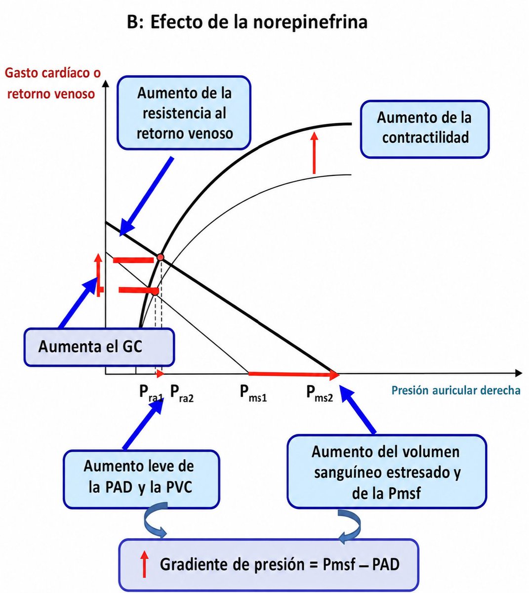 LeslieMegom's tweet photo. 🫁🫀🧠Monitoreo hemodinámico avanzado: perlas para la interpretación fisiológica y toma de decisiones clínicas☕️💎
🫀El Gasto cardiaco es un parámetro global → no garantiza perfusión tisular adecuada órgano-específica.
💎No tratar números. Trata la perfusión.
No es “normalizar GC ”, sino:
👉 optimizar DO₂ y perfusión tisular
💎1️⃣7️⃣ PERLAS CAFETERAS ☕️
✔ El GC debe interpretarse junto con:
RVS, DO₂, variables dinámicas
🔹 1. “La presión no es perfusión”
👉 Una PAM normal NO garantiza perfusión tisular adecuada
Puedes tener:
▪️PAM normal + bajo CO → hipoperfusión oculta
▪️PAM baja + CO alto → perfusión suficiente
💎  Lactato, SvO₂ y signos clínicos valen más que la presión aislada
🔹 2. El gasto cardíaco es necesario, pero insuficiente
👉🫀 El  GASTO CARDIACO es una variable macrocirculatoria.
😵No refleja:
▪️Microcirculación
▪️Extracción de O₂
💎 El verdadero objetivo es DO₂/VO₂ balance, no solo gasto cardíaco 🫀
🔹 3. La precarga NO se mide con presiones☝🏻🤓
👉 PVC (CVP) y PCP son malos predictores de respuesta a líquidos 🚿
💎Mejor usar:VPP (variación de presión de pulso)📈📉
▪️VVS (variación del volumen sistólico)
▪️Test de elevación pasiva de piernas (PLR)
 💎 No preguntes cuánto volumen tiene el paciente, sino si responderá a más volumen
🔹 4. Fluid responsiveness ≠ necesidad de líquidos 🚿
👉 Que el paciente responda a fluidos NO significa que los necesite⚠️
💡 Ej.Paciente séptico con edema pulmonar puede ser “respondedor” pero no candidato a líquidos🪣
💎Dar líquidos solo si mejora perfusión SIN causar daño📛
🔹 5. El retorno venoso manda (Guyton > Frank-Starling)
👉 El gasto cardiaco 🫀está limitado por el retorno venoso
↪️Presión media sistémica (Pms)
▪️PVC
▪️Gradiente de retorno venoso
💎Vasopresores (ej. norepinefrina) pueden ↑ GC🫀 al mejorar retorno venoso
🔹 6. La poscarga es un modulador dinámico
👉 No es solo “resistencia” → afecta directamente el volumen sistólico 
▪️↑ afterload → ↓ eyección
▪️↓ afterload → ↑ CO (si el corazón lo tolera)
💎En shock séptico → problema principal = vasoplejía
🫀En cardiogénico → reducir afterload puede beneficiarse el GC
🔹 7. La frecuencia cardíaca tiene una “zona óptima”
👉 Más rápido NO  MEJORA ⚠️
Taquicardia:
▪️↓ llenado diastólico
▪️↓ VS
💎 En disfunción diastólica, controlar FC mejora GC más que aumentar contractilidad.
🔹 8. Ecocardiografía
▪️Permite evaluar en minutos:
▪️precarga
▪️función ventricular
▪️causas de shock
💎No monitorice a ciega mira el corazón.
🔹 9. El lactato no siempre es hipoxia
👉 Lactato elevado puede ser por:
▪️Hipoperfusión
▪️Estrés adrenérgico
▪️Disfunción mitocondrial
💎 Tendencia del lactato > valor aislado
🔹 10. La SvO₂ puede engañar
👉 SvO₂ alta NO siempre es buena
En sepsis:
▪️Extracción alterada → SvO₂ normal/alta con hipoxia tisular
💎 Interpretar SvO₂ en contexto clínico
🔹 11. Microcirculación: el “punto ciego”
👉 Puedes corregir macrohemodinámica y fallar en microcirculación🫀
▪️Ej. En el séptico con GC alto pero mala perfusión capilar
💎 Tiempo de relleno capilar y perfusión periférica son claves
🔹 12. Ventilación mecánica cambia la hemodinámica
👉 Aumenta presión intratorácica → ↓ retorno venoso.
💎 Interpretar variables dinámicas solo si: Ritmo sinusal, ventilación controlada, VT adecuado
🔹 13. Vasopresores No es solo TAM
👉 Norepinefrina:
↑ RVS
↑ retorno venoso
↑ Gc
💎 No retrasar vasopresores📈
🔹 14. Inotrópicos: usar con objetivo 🎯👉 Dobutamina: Util si bajo GC + perfusión deficiente🫀
💎Si no mejora perfusión → suspender (evitar daño)
🔹 15. Monitoreo dinámico > estático
👉 Variables dinámicas predicen respuesta a intervenciones
💎 La hemodinamia es un sistema en movimiento.
🔹 16. Fenotipos de shock⚠️
▪️No todos los shocks son iguales:
▪️Tipo  GC ➡️ RVS Tratamiento clave
🩸Hipovolémico ↓ ↑ fluidos
🫀Cardiogénico ↓ ↑ inotrópicos
👾Séptico ↑/↓ ↓ vasopresores
⚠️Obstructivo ↓ ↑ resolver causa
💎Identifica el fenotipo antes de tratar
🔹 17. Menos es más (fluid stewardship)👇🏽