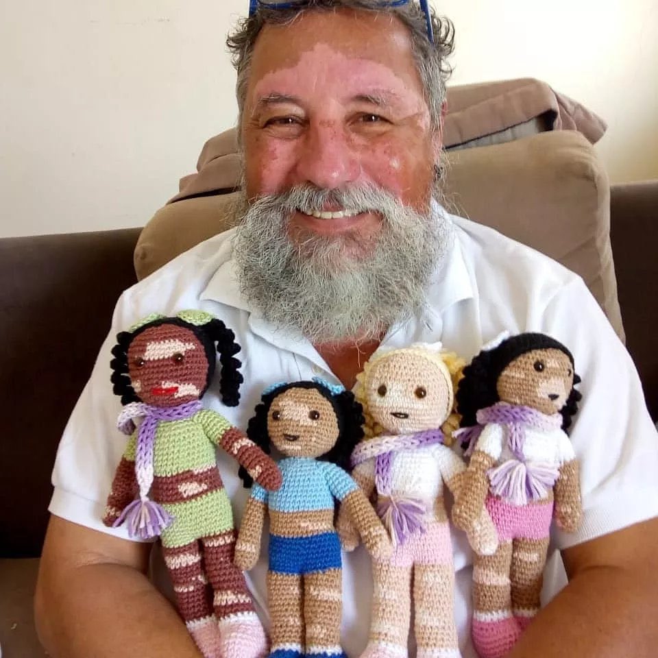 EnsedeCiencia's tweet photo. 🔴 | Un abuelito con vitíligo crea muñecas para niños con la misma condición. https://t.co/PgxP8EwHAD