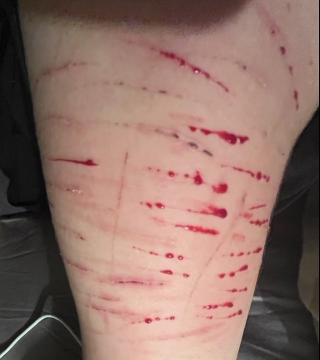 n4useoux's tweet photo. sesh from last night (if u saw my last post this is where the glowing tissue blood came from)
‼️sfx makeup
#shtwtt #slittwt #shhtwt https://t.co/eouVB21k4n