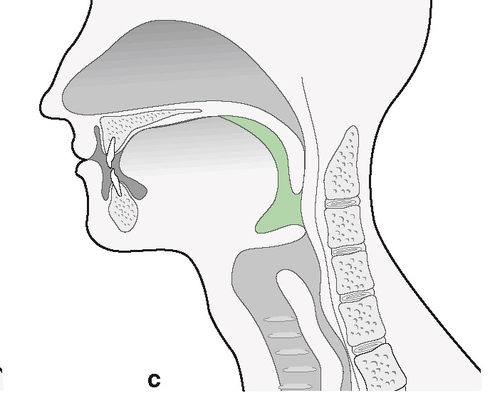 PasionAnatomia's tweet photo. 📌 Fase faríngea (2): la #deglución se produce de forma refleja. En primer lugar se cierran la entrada a la #nasofaringe (c) y la contracción del esfínter muscular en el istmo de las #fauces y la lengua impide el regreso del alimento a la boca y lo empuja hacia la hipofaringe (d) https://t.co/Xux8FFydBd
