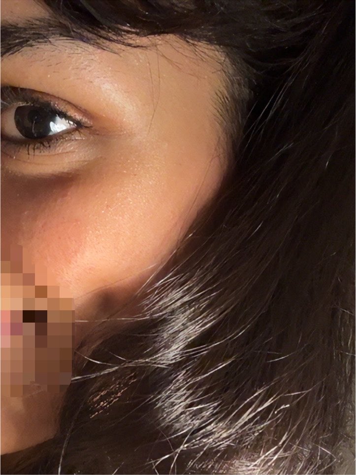 meow7e's tweet photo. شكراً كوتن سكن 
هذه بشرتي بعد استخدام كورس بينك برست لمدة شهر 

من بعدها طفرت ممكن تخفضون بالاسعار يرحملي والديكم 🙏🏽🙏🏽🙏🏽 https://t.co/JWC65xz5od