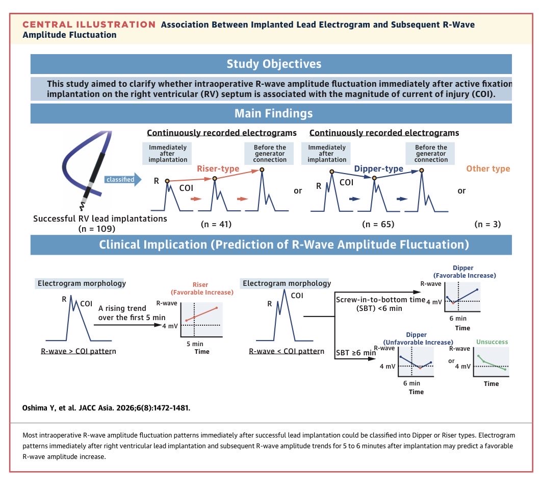 satoshiokamd's tweet photo. The intraoperative R-wave amplitude fluctuations could be predicted from the EGM morphology immediately after RV lead implantation. @yoshitake_3  @satoshiokamd 
https://t.co/9lmEReBU9s https://t.co/PT1tbpOGbU