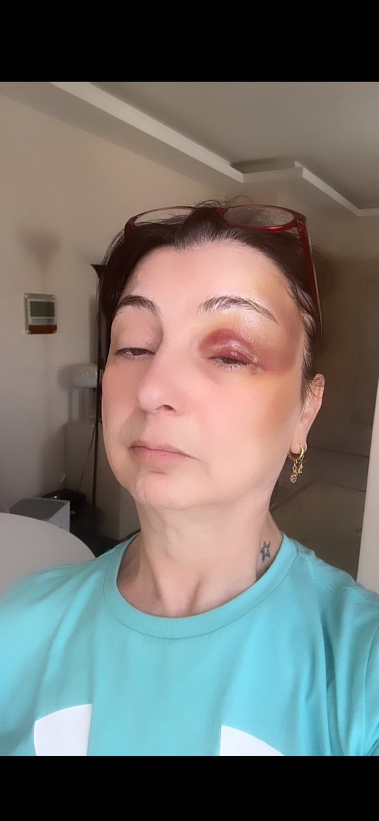 rosefruitx's tweet photo. Biz ne zaman bu kadar duyarsız olduk?

İhtiyacı olan insanların “rica” ile yaptığı paylaşımları RT etmeyecek kadar egolu… Görmezden gelecek kadar uzak…

İnsanlar şunu unutuyor: “Bugün bana, yarın sana.”

Kimse başına gelmeyecek sanıyor ama hayat herkese aynı değil.

Ben üzülüyorum… Ama aslında bu, onların vicdanını değil egolarını gösteriyor.