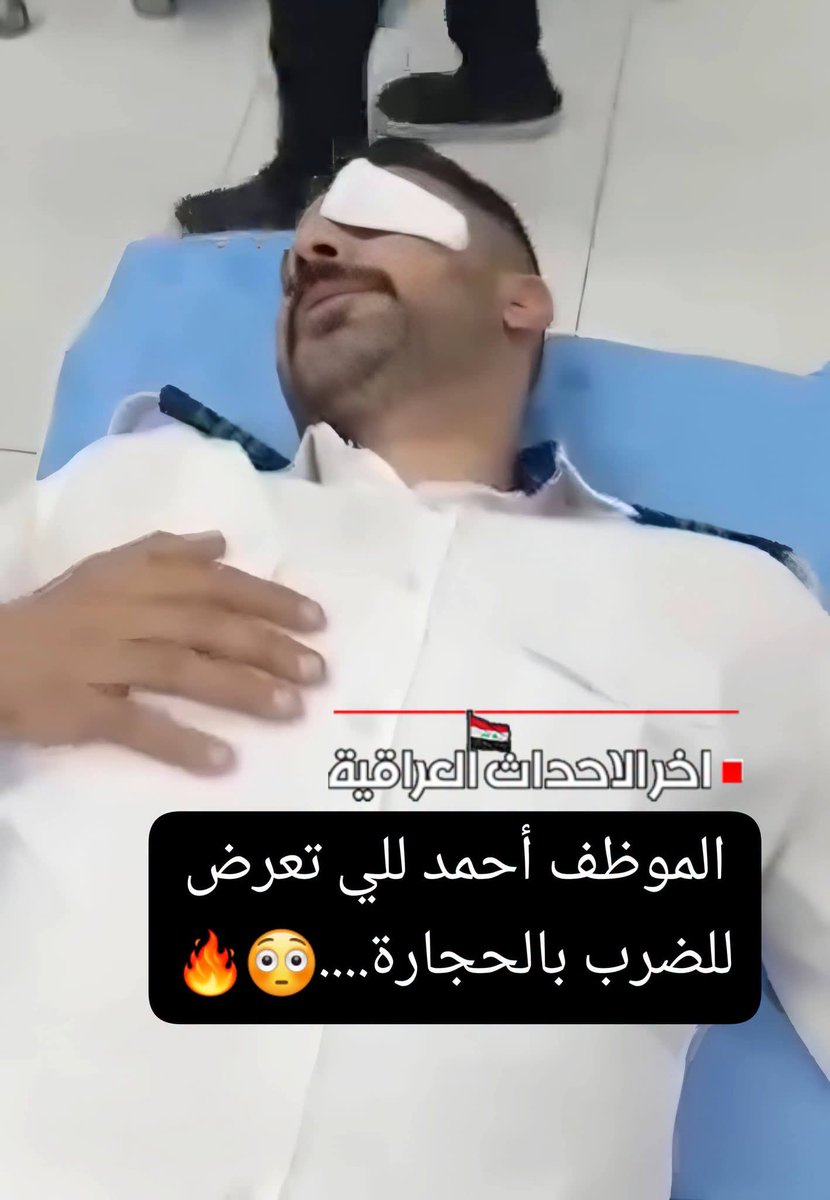 samershaker919's tweet photo. هذا الي كدامكم  يشتغل بقطار وقبل يومين كان شايل زوار  يوصلونهم لــ #كربلاء  بس ففقد عينه ..❗

الشاب اسمه #أحمد_محمد المكلف بفحص البطاقات بالقطار رقم 22  .. 
خطية اكو شاب ملطلط من السماوه يشمر طابوك على القطار وهفهم بطابكوه كسرت الجامه والجامة راحت على عينه وطفته ..؟؟خطية والله .. 
بس الي اريد اعرفه هاي الثقافة مالت يشمرون طابوك على القطار منين اجتنا وليش مستمرة ..⁉️
ليش الأهل الي يصيرون على خطوط السك ما يبوعون جهالهم ليش مخليهم مخابيل كامشين الحصو والطابوك ودك على القطار .؟
انت رب العائلة مسؤول على هاي القضية مو الدولة ..
ابنك اكمشه وربيه وعلمه هذا القطار مالتنا ومالت كل الشعب ..
هسه شنو ذنبه الموظف راحت عينه ؟

#اخر_الاحداث_العراقية
