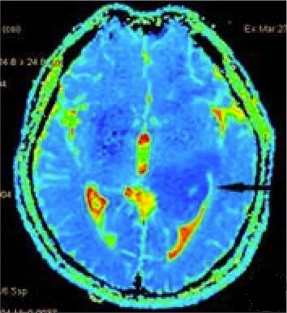 Image credit: Adapted from BMC Neurol. December 2022. https://doi.org/10.1186/s12883-022-03026-0. CC BY 4.0