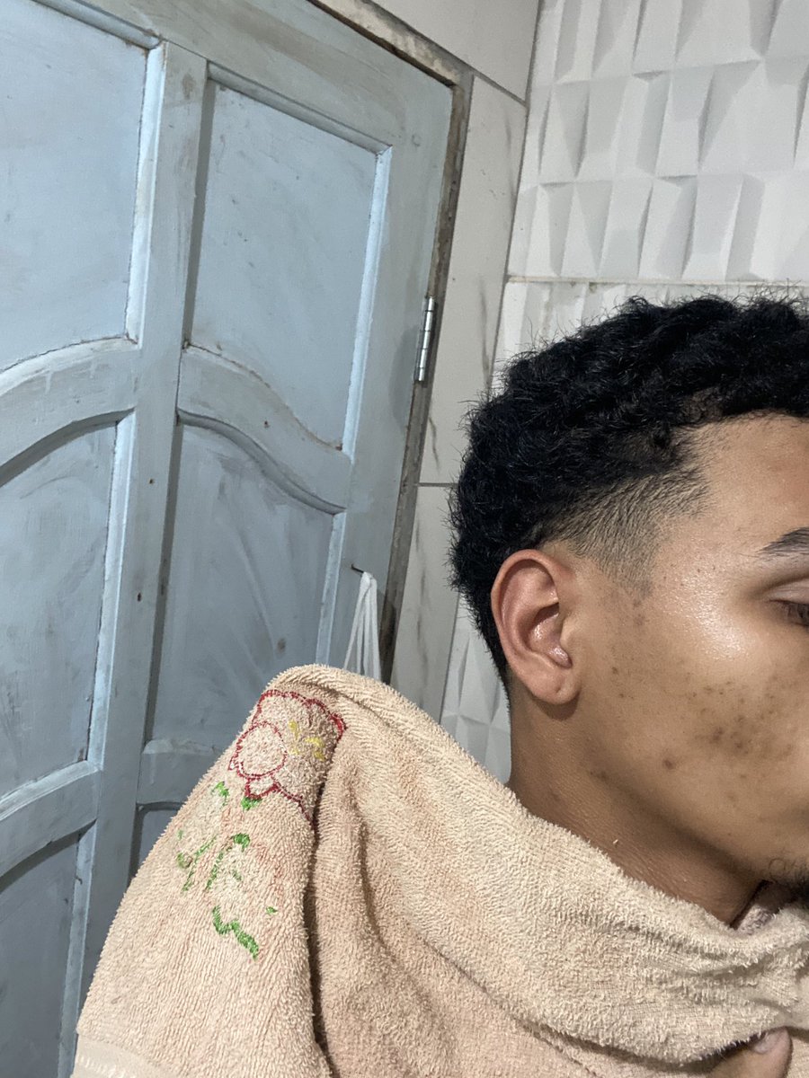 vnsamp's tweet photo. cabelo já tá assim e eu tenho q sair com a bb no sábado https://t.co/1rA5HwpczI