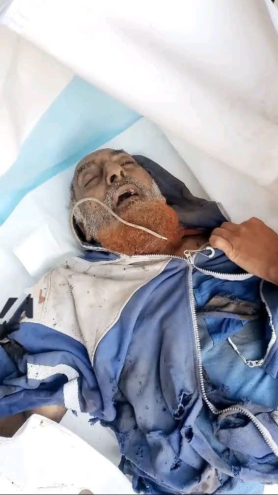 salimalyafei10's tweet photo. عرفتوه هذا الرجل المسن ..
إنه الجنوبي ابن الضالع وهو ذاهب لصلاة الفجر
أحد ضحايا قصف الطيران السعودي
07/يناير/2026 https://t.co/V1cphbwOLv
