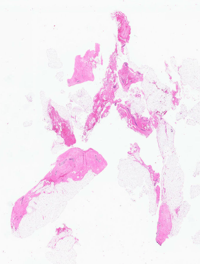 fouad_boulos's tweet photo. Rush biopsy :)
#PathArt https://t.co/Zh0Inu0qNy