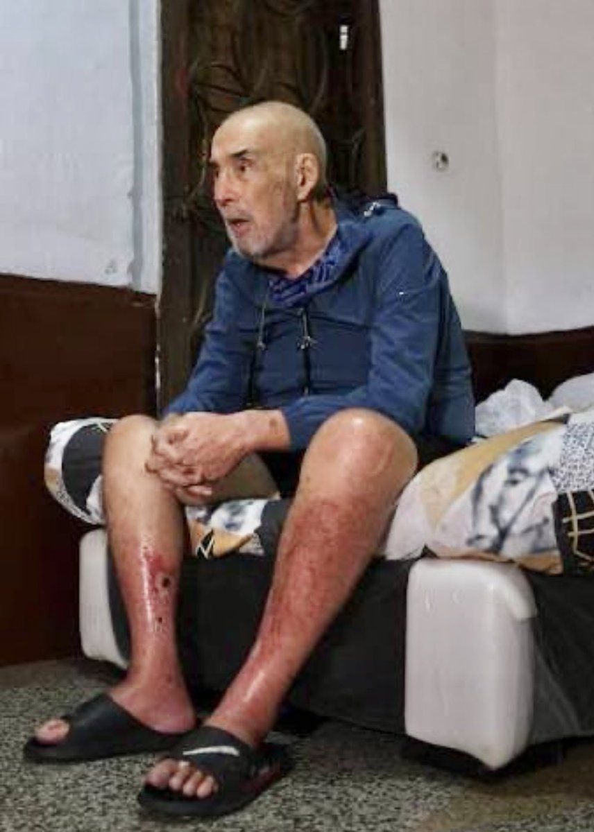 PerkinsRocha's tweet photo. La muerte de José Breijo no es un hecho aislado; es el resultado de un sistema criminal que tortura, despoja y asesina bajo la figura del presidio político. Excarcelado de Tocuyito en condiciones inhumanas, al Sr Breijo se le negó la amnistía y se le condenó a un arresto domiciliario que se convirtió en una prolongación de su suplicio. Al regresar a su hogar, descubrió que su propio secuestrador, un funcionario del Grupo de Operaciones Estratégicas (GOES), habitaba irregularmente su propiedad. Obligado a pernoctar sobre un colchón a las puertas de su casa para exigir la devolución de su patrimonio, al final por su valiente reclamo, pudo recuperar su vivienda desvalijada.
A este ciudadano de la tercera edad se le imputó falsamente el delito de terrorismo con el único fin de confiscar de hecho sus bienes. José Breijo ingresó sano y salió de prisión con cincuenta kilogramos menos, enfermo, quebrado emocionalmente y bajo una custodia estatal que jamás garantizó su vida. Exigimos justicia inmediata ante este crimen de Estado. La muerte de un hombre de bien no puede quedar impune ante la historia ni ante la justicia que queremos recuperar. No seríamos humanos, no mereceríamos estar en Venezuela, no nos merecemos un país ni recuperar una República, si volteamos la cara ante este y tanto hechos similares y lo lanzamos al olvido... Gracias @CarlosJRojas13 por haber valientemente honrado los últimos días de Jose Breijo…