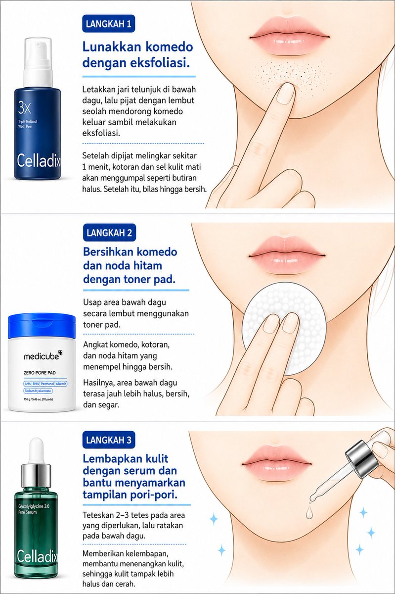 lostdr4ft's tweet photo. Cara hilangin KOMEDO BANDEL di dagu yang viral di Jepang pake produk ini ✨️🫵🏿 https://t.co/sElUoESy7J
