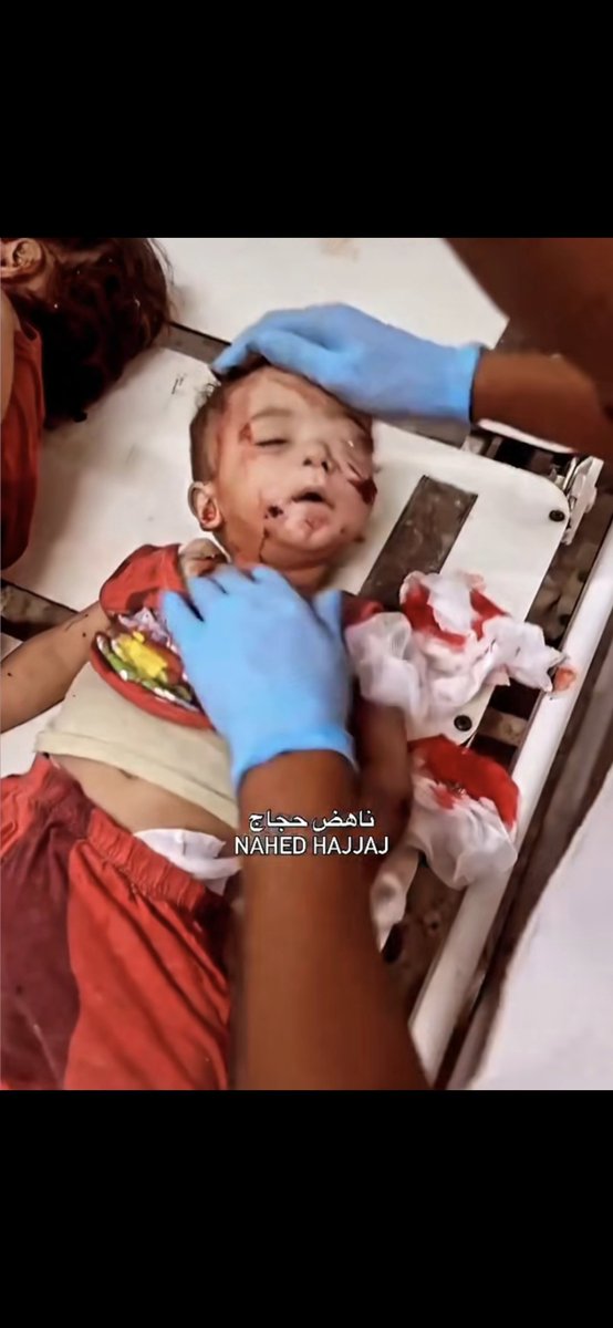 LawyerAdamHouda's tweet photo. The terrorist state of israel has an insatiable lust for slaughtering little children. A sick, genocidal, lunatic state. 

Where are you shameful journalists, zionists &amp; politicians on this unforgivable outrage?? #IsraeliNazis #PalestinianHolocaust #FinalSolution #auspol https://t.co/syEy5Avhtw