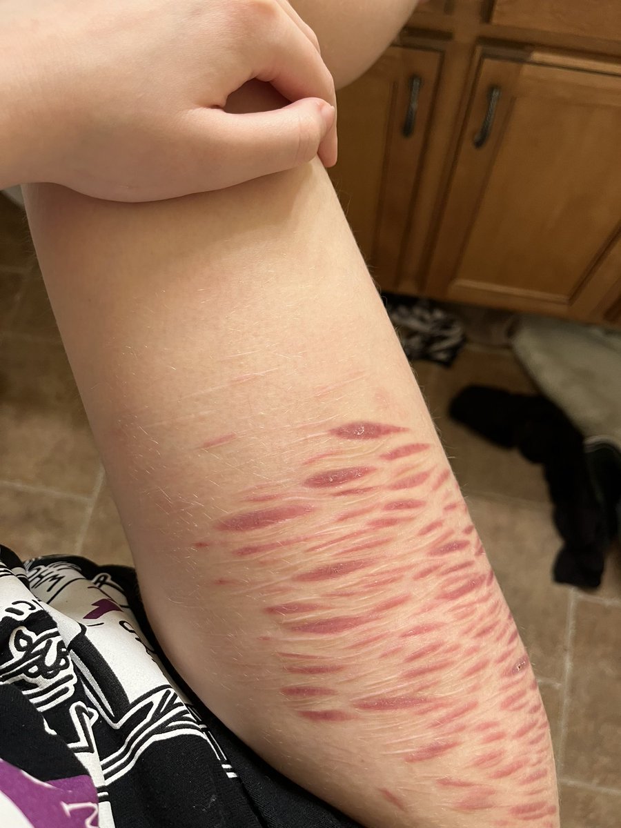 liteasafeather7's tweet photo. Fully healed special effects https://t.co/W4E2lyTcpP