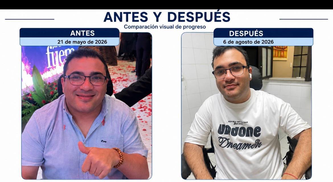 JuanpiDolande's tweet photo. No se trata solo de los kilos que se van, sino de la disciplina que llega. Entre estas dos fotos hay poco más de dos meses de constancia, sacrificio y compromiso. Aún falta camino, pero hoy celebro el progreso. Seguimos: sin prisa, pero sin pausa. 💪♿️✨ https://t.co/gu2bpFu2Ff