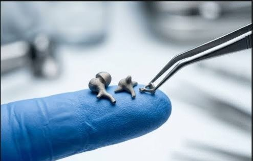 TTendenciaX's tweet photo. "Audición":
Porque en Sudáfrica lograron restaurar la audición de un paciente usando huesos del oído impresos en 3D. https://t.co/XTRpYvFEz4
