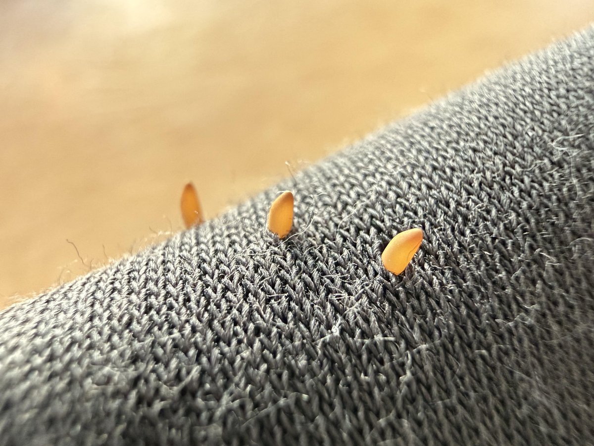 BZewar78757's tweet photo. What are these strange egg-like grains on my jumper after drying it outdoors?

I washed my jumper and left it to dry outside on a metal drying rack under some trees. It wasn’t touching any plants and stayed there for about two days. https://t.co/yjeAEdP8AP