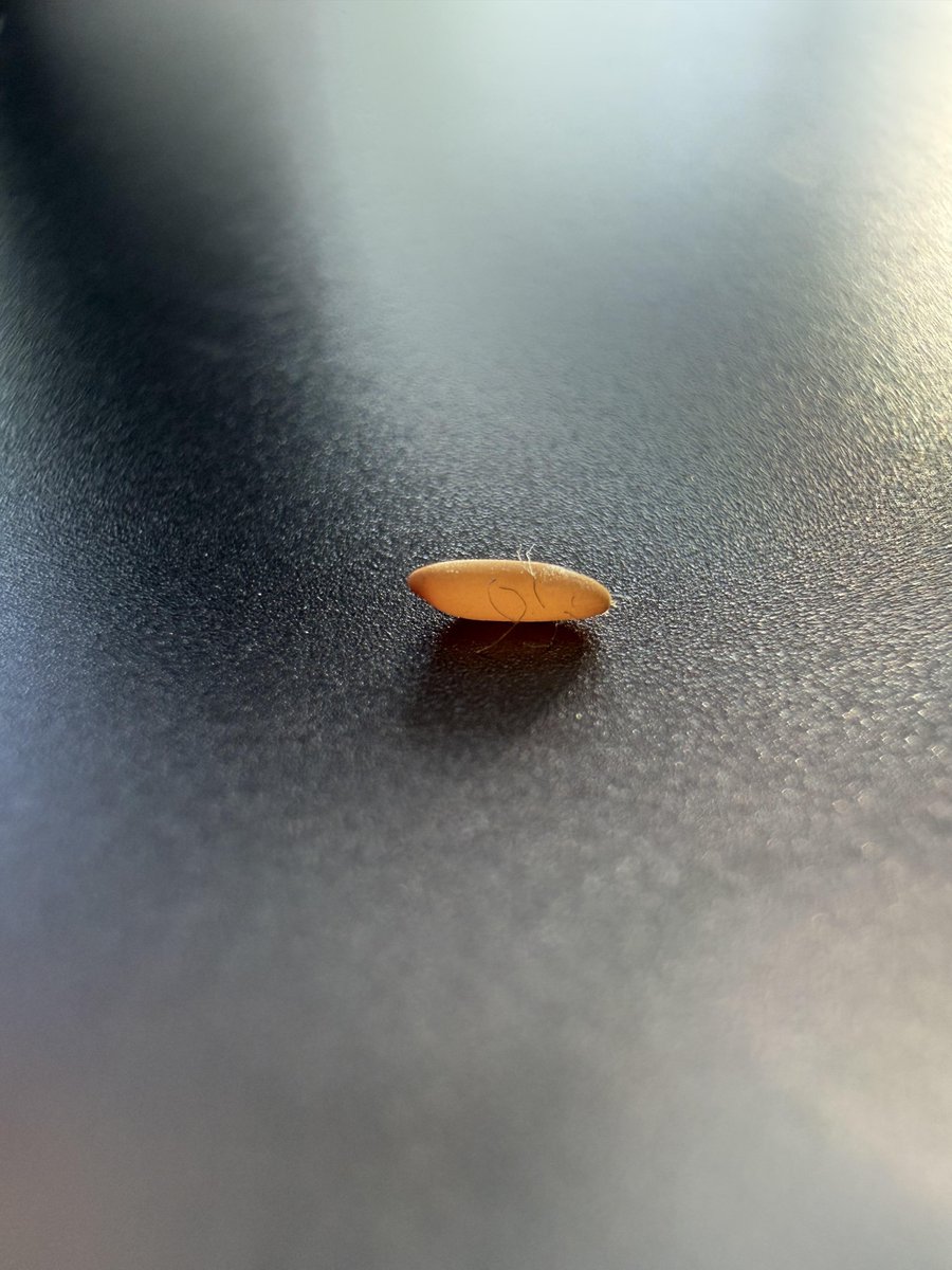 BZewar78757's tweet photo. What are these strange egg-like grains on my jumper after drying it outdoors?

I washed my jumper and left it to dry outside on a metal drying rack under some trees. It wasn’t touching any plants and stayed there for about two days. https://t.co/yjeAEdP8AP