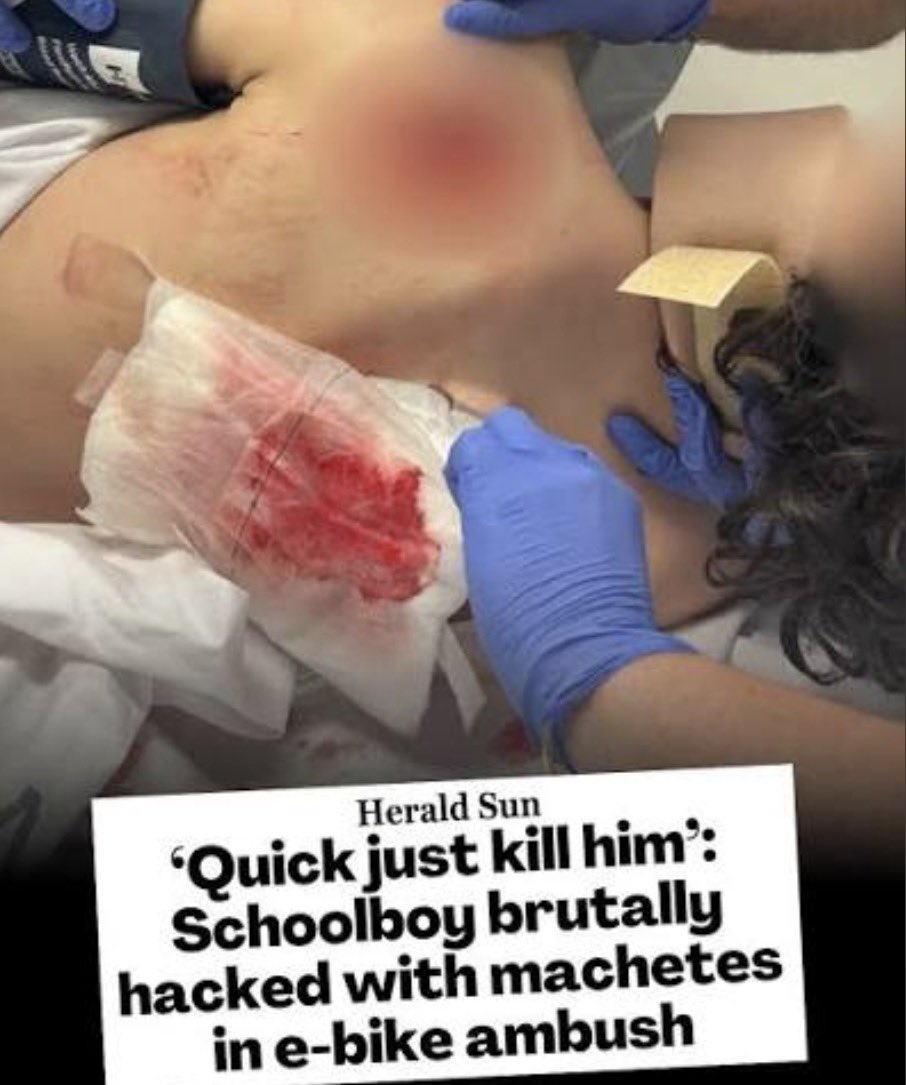 TruthFairy131's tweet photo. Melbourne, Australia 🇦🇺 

A schoolboy was brutally hacked with machetes in a Wantirna park has recalled the harrowing moment his masked attackers slashed, stabbed & tried to kill him for his $10,000 e-bike.

“They chased me down saying: kill him right now’, and ‘quick, quick just kill him”.

"I thought they were going to kill me and was begging them not to and asking them why they were doing this”.

"They then got on my e-bike and rode away” said the victim.

In Melbourne having nice things makes you a massive target due to mass immigration & dangerous multiculturalism 🎯 

How many kids are you willing to sacrifice Australia? 

Every person staying silent while kids are being hacked to death on our streets is complicit 😡