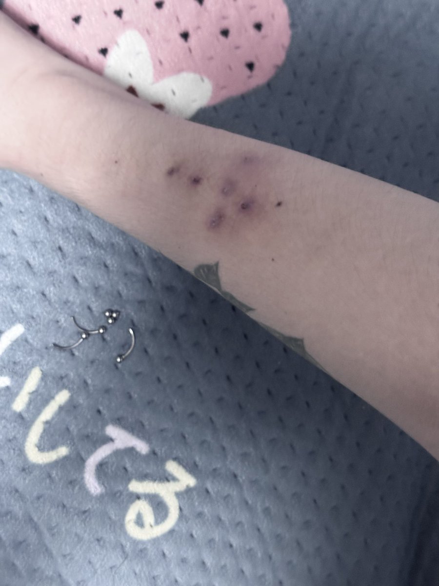 Lulupdol's tweet photo. 摘掉了😞#特效妆 https://t.co/N9PUdeVq2v