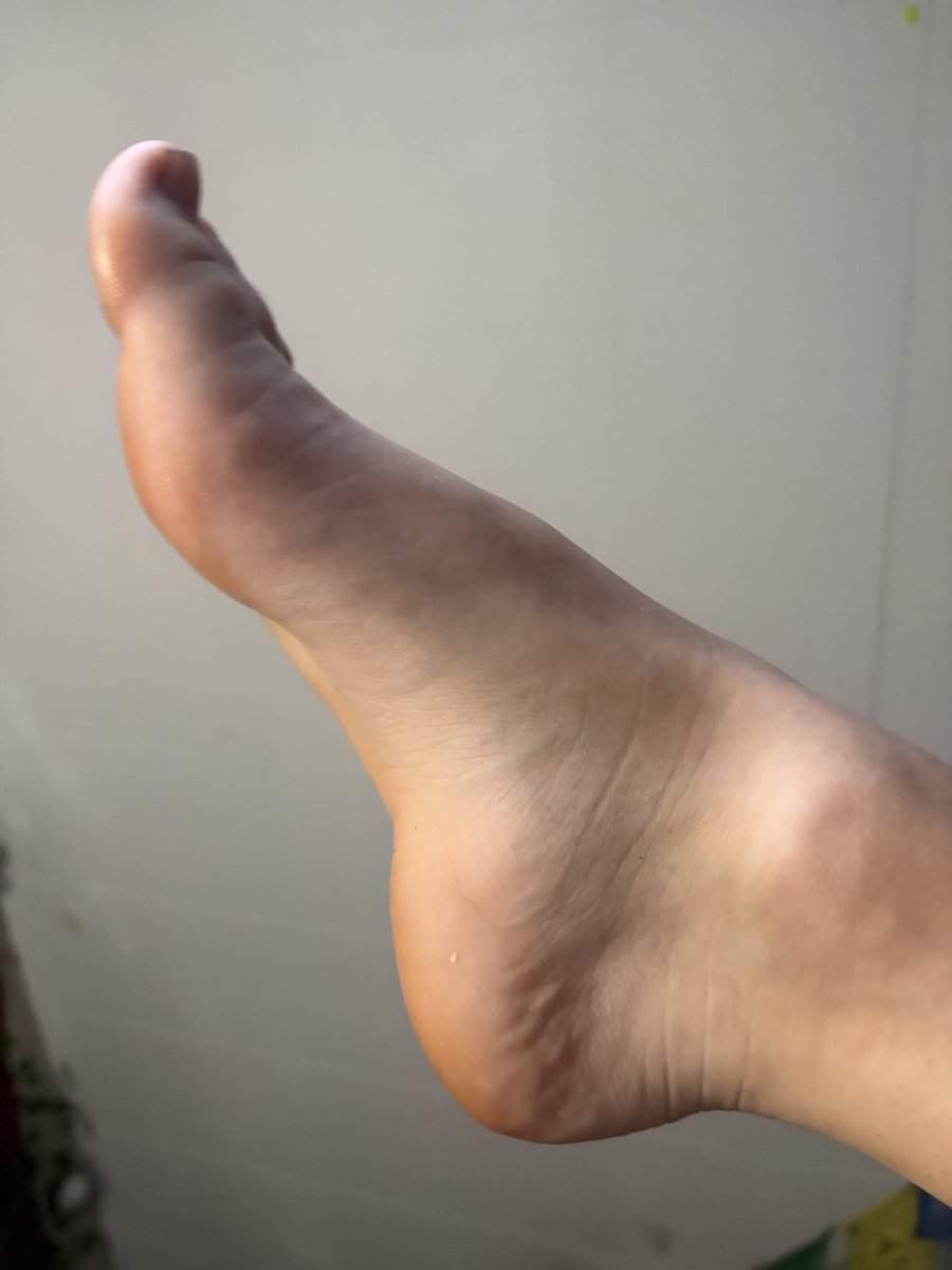 Gofzzurself's tweet photo. Feet pics, no limits  🤤
Dm for sugar baby or feet😋
#feetfetısh #feet #feetworshi̇p #feetfetıshly #sugar #sugardaddy #sugarbaby https://t.co/b21fC8L09k