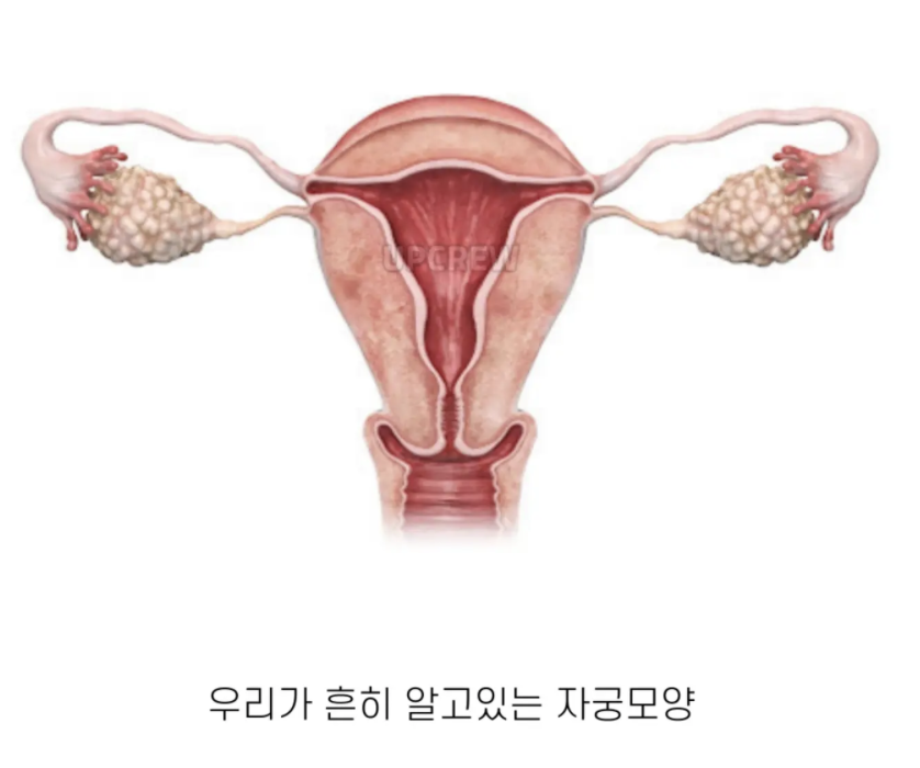 jutingstar9999's tweet photo. 의외로 생리통 강도가 사람마다 다른 이유래 ㄷㄷ
.
>우리가 흔하게 알고있는 자궁 모양은 첫짤 사진이지만
자궁 모양은 저거 하나가 아니었슨;;
>두번째 짤 사진처럼 다양한 모양이 있음
>예를들어 자궁이 둘로 나뉘거나 한쪽만 있거나 새싹 모양등 다양한 형태...
>자궁기형이라고 부르는데 어감이 좀 이상하지만 의외로 흔하다고!
>그래서 유난히 생리통이 심한 사람은 산부인과 진료 권장
