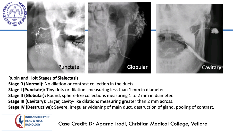 teamishnr's tweet photo. #caseoftheweekanswer

Please find the answer
#radiology #caseoftheweek #headandneck #radiologycases #dailywork #ISHNR #teaching #research #imaging #FOAM #FOAMRad #FOAMMed

Visit our website: https://t.co/dZHpVsTMdo
All Cases: https://t.co/0xaPvoBy5H https://t.co/JdmERMp0O3