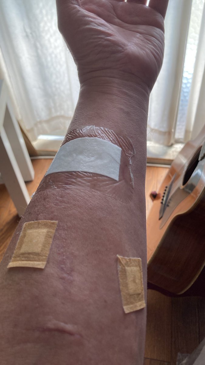 kaz6thlife's tweet photo. ãMy #dialysis #simptom's memoã
ð¥ðð©ââïžð©žðð©»â¿ïžðªð¥Œð¡ïž
#人工è¡ç®¡ ã¯ãèœã¡çããŠããŸãã https://t.co/jyV7GvrKB6