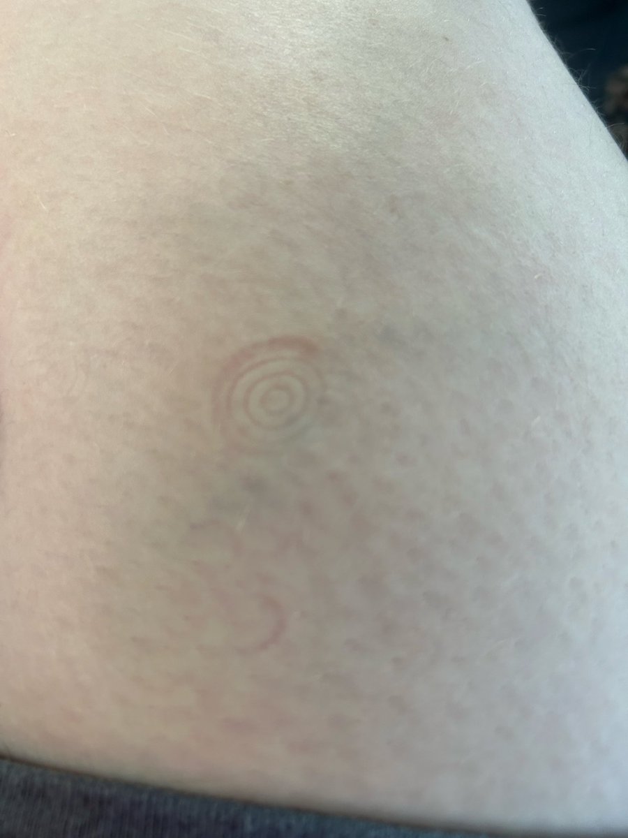 mooncake890's tweet photo. this cutesy spiral on my leg ꩜ https://t.co/ZAWwfyJ5fy
