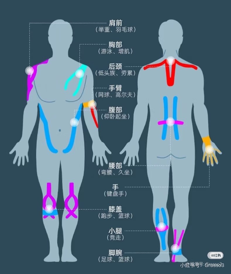 Nanguwakaki's tweet photo. The tape decorations on Enigma seem to be tapes to prevent muscle strains https://t.co/Z1evpuFoBG