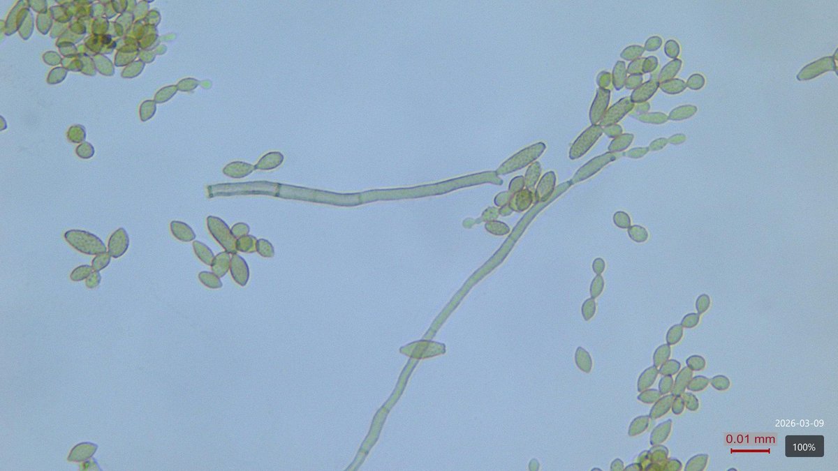 SPINFERT's tweet photo. 🌱 Friend or foe? The hidden world of fungi and seed fitness 🍄  Not all fungi are harmful. In SPIN-FERT, we're exploring how different fungi influence the health and vitality of crop seeds. #MissionSoil #SoilBiology #PlantHealth https://t.co/6c6924xJ7F