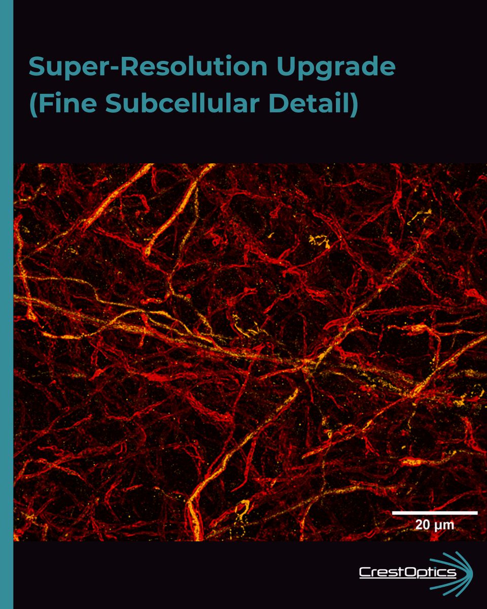 CrestOptics's tweet photo. 🔬#ImageOfTheWeek | Powered by the #Multimodalmaging
Your samples hold complex stories; limiting your view means missing half the picture.
📸 The images below show what this looks like in mouse cerebellum!
More here: https://t.co/Jf1uUxZoK1
#FluorescenceFriday https://t.co/tlnSY0GUMP