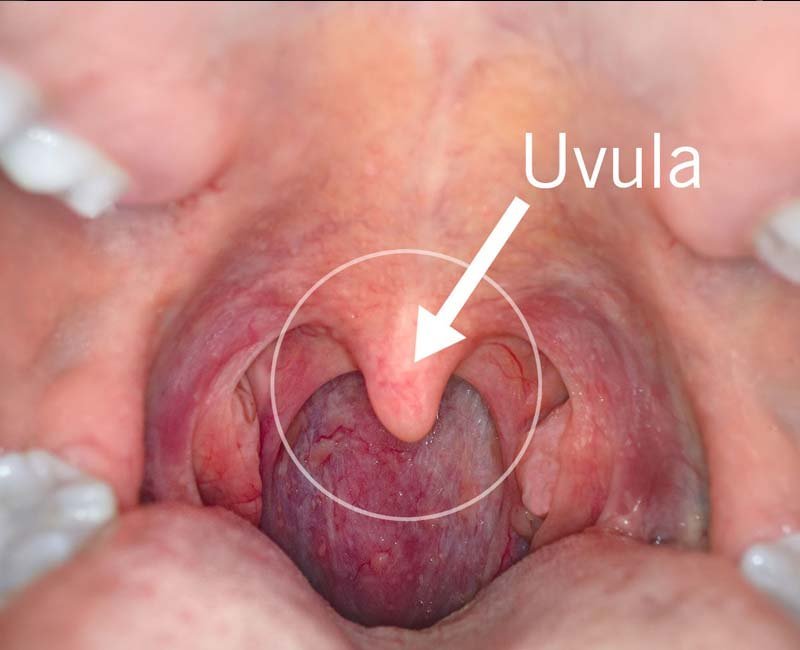 DrspiceO24799's tweet photo. Cutting of the uvula is deeply engrained in African traditions. Can someone explain why they do it? 

#AskAMan | EFCc | Edwin Sifuna
#InstitutionalHousing | Chelsea Gray https://t.co/ljLWwTy3bw