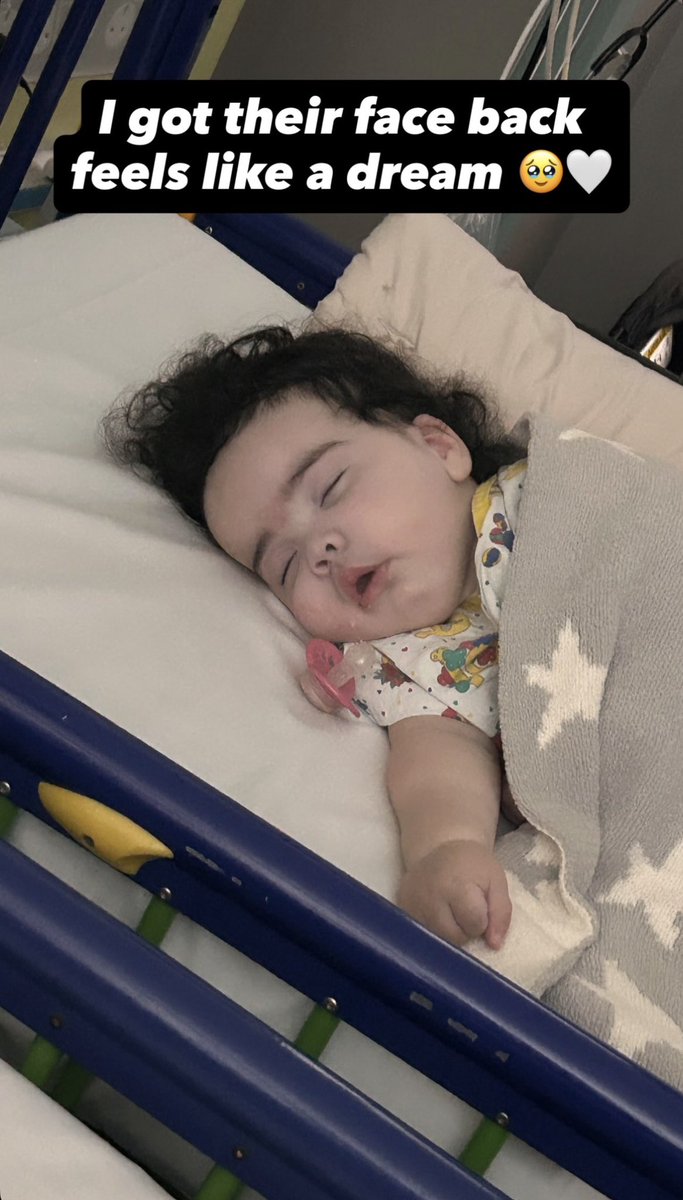 JesyNelson_stan's tweet photo. Jesy posts that her daughters have had surgery and no longer have their NG tubes and she can finally see their faces properly 🥹🙏

“I got their face back feels like a dream 🥹🤍” https://t.co/m6viGaN9Rd
