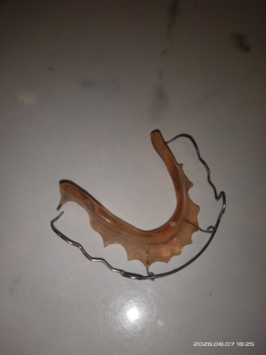 aumeong's tweet photo. Setelah bertahun tahun lepas behel, akhirnya balik ke ortho lgi krn retainer patah😭😭
 
Dan dijelasin ortho kalo cara cuci retainer yg benar sikat satu arah dgn lembut pke air doang. Gak boleh pke pasta gigi dll. Pantesan punyaku berubah warna dan berkerak hadeh https://t.co/A0caUhYcL1